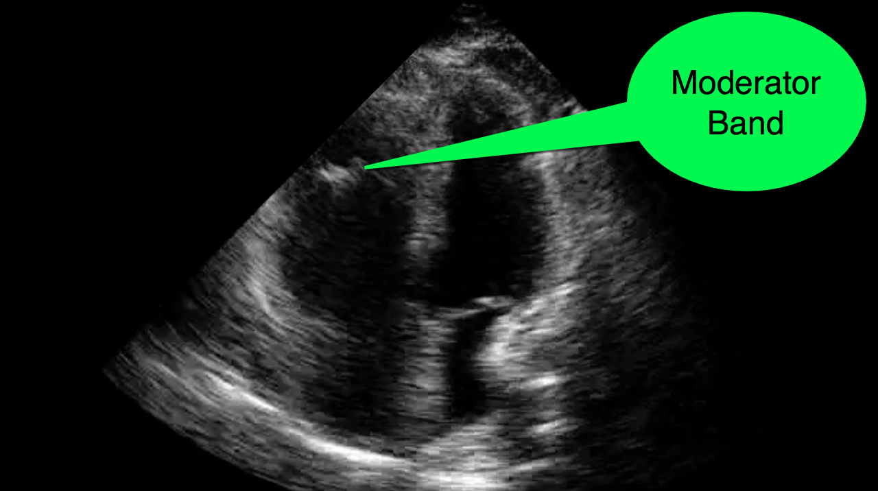 UMEM Educational Pearls University of Maryland School of Medicine